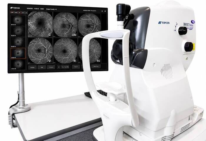 Angiografia Fluoresceínica em São Luís