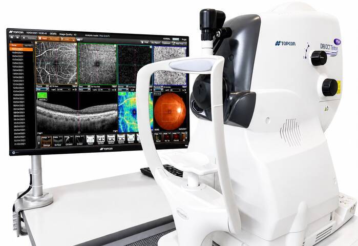 Angiografia por OCT (OCTA) em São Luís